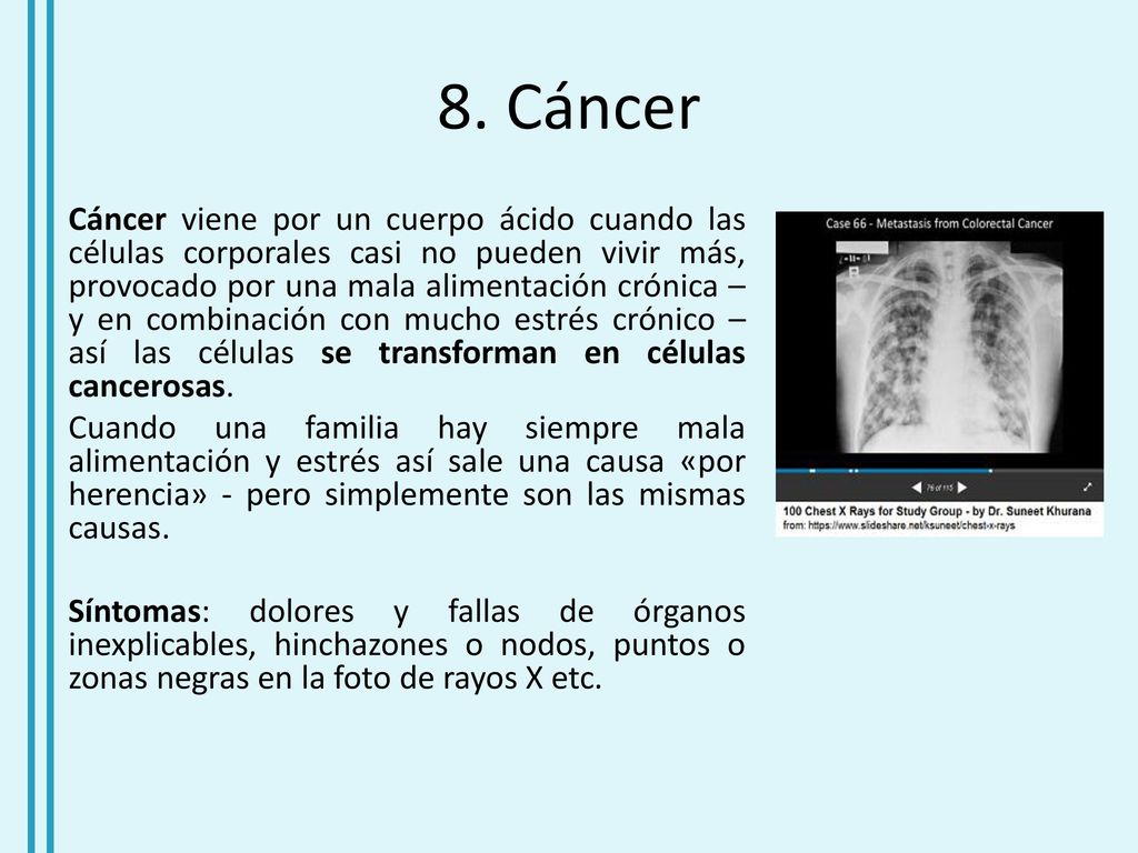 Tipos de dolores de cabeza slideshare